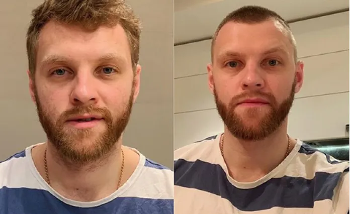 Дмитрий Мильчаков принял эстафету от Андрея Степанова и сменил причёску